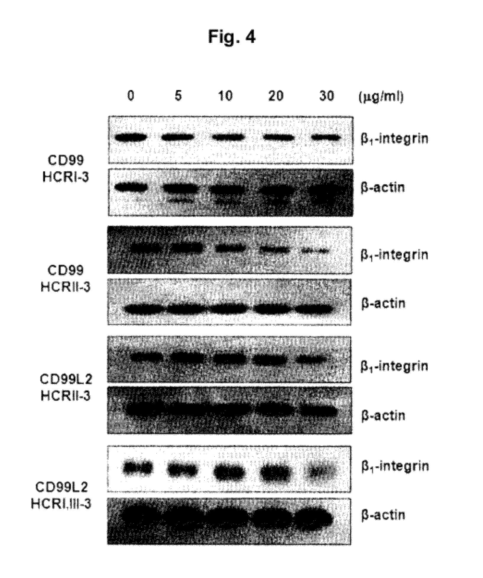 Isolated polypeptides used for treatment of inflammatory diseases and inhibiting cancer metastasis