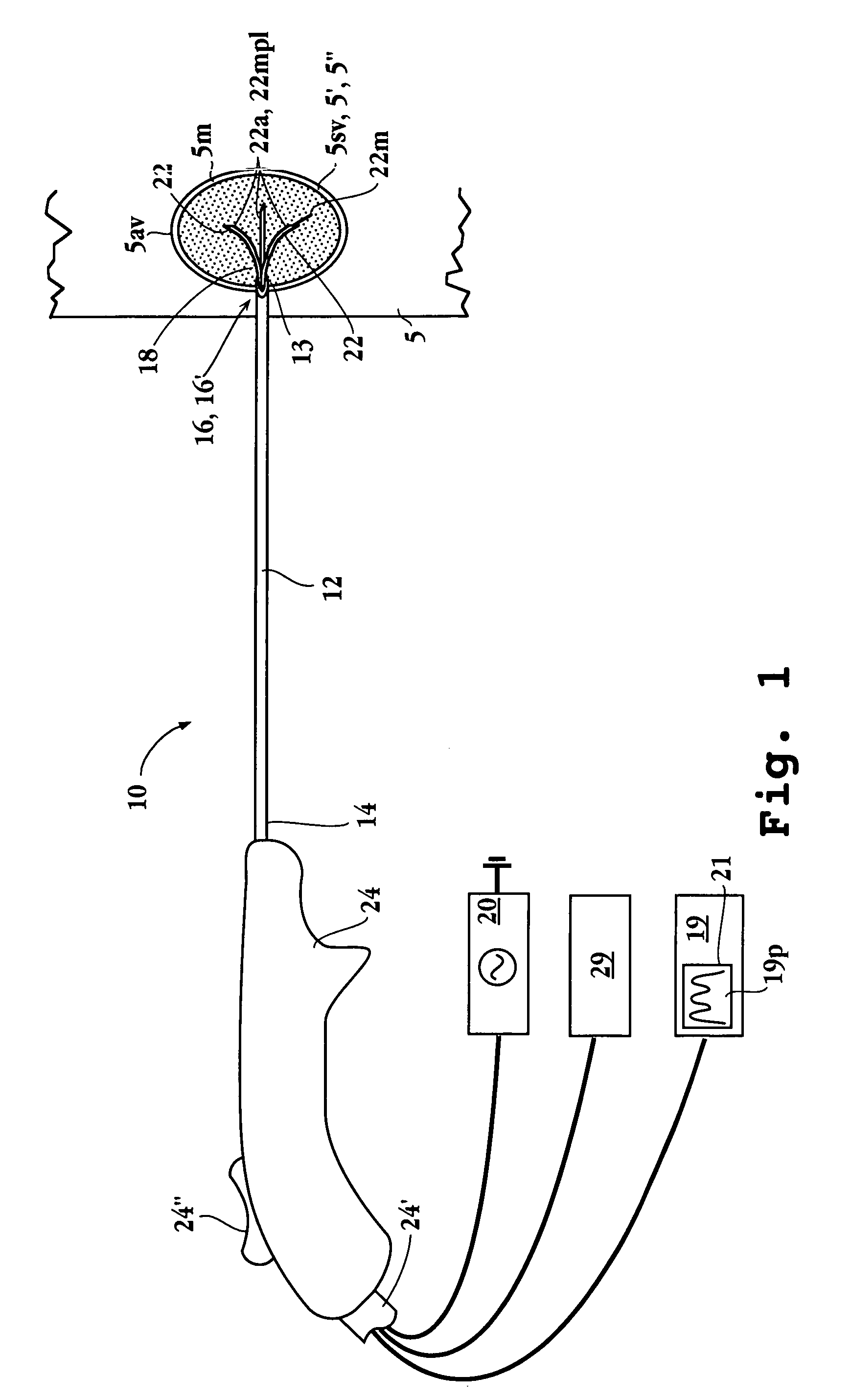 Impedance controlled tissue ablation apparatus and method
