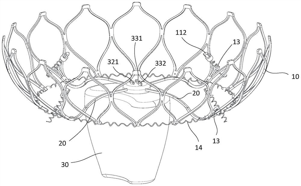 Heart valve adjustable auxiliary device and system