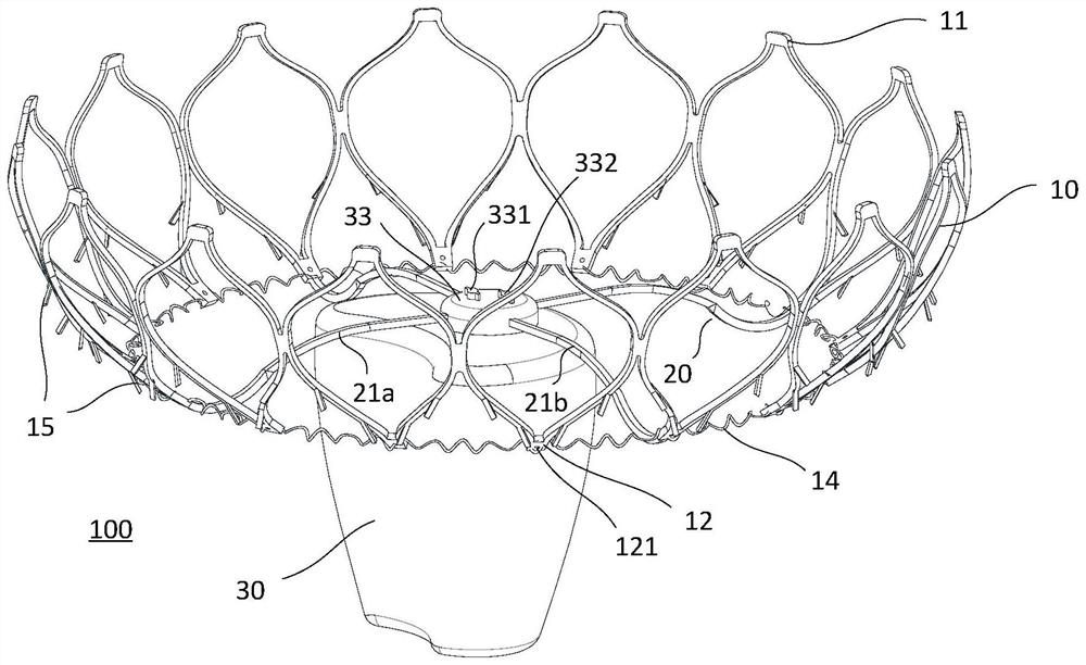 Heart valve adjustable auxiliary device and system