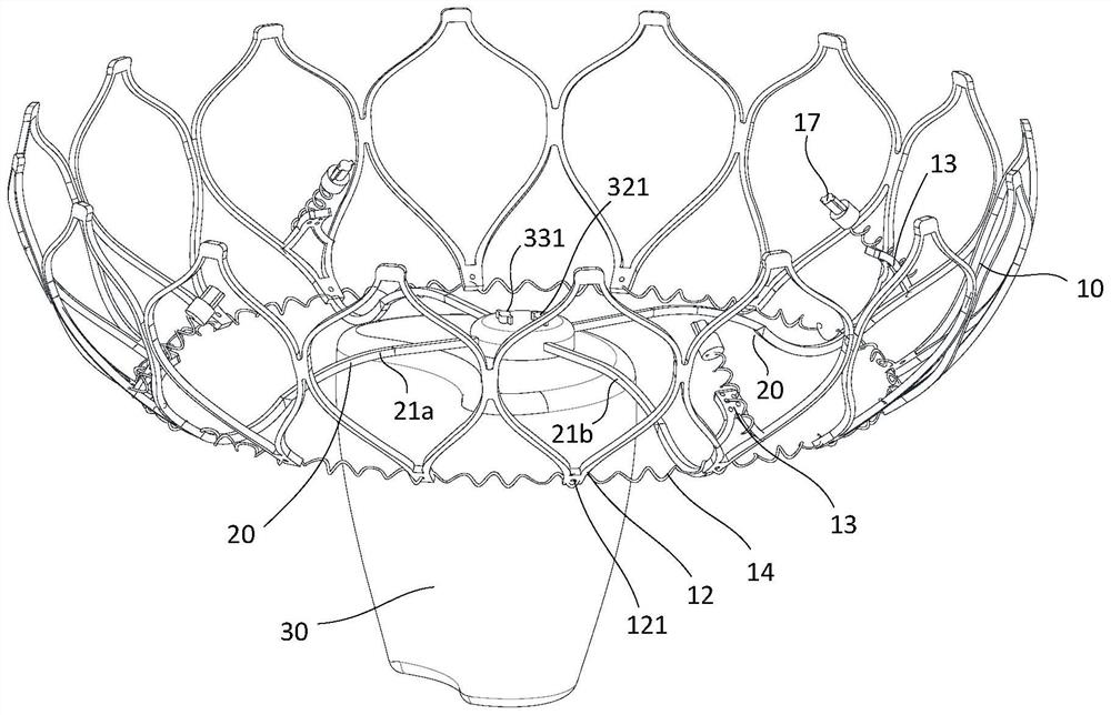 Heart valve adjustable auxiliary device and system