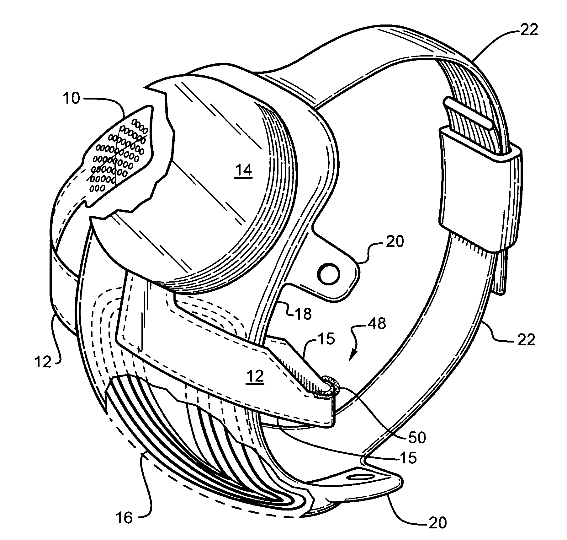 Retinal prosthesis and method of manufacturing a retinal prosthesis