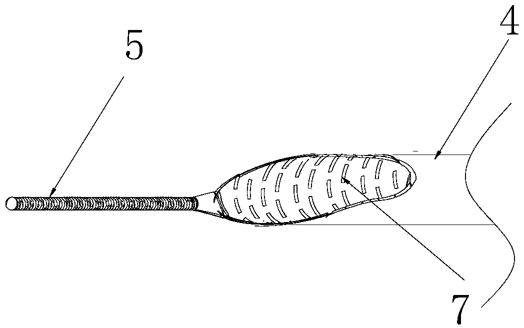 Auxiliary catheter for guiding delivery of endovascula stent
