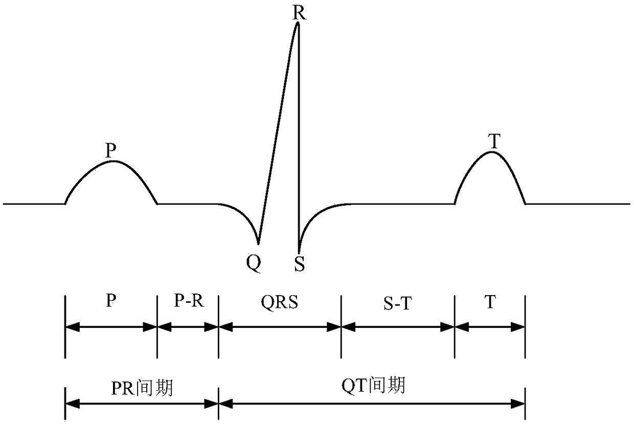 Ventricular fibrillation detection method, storage medium and device