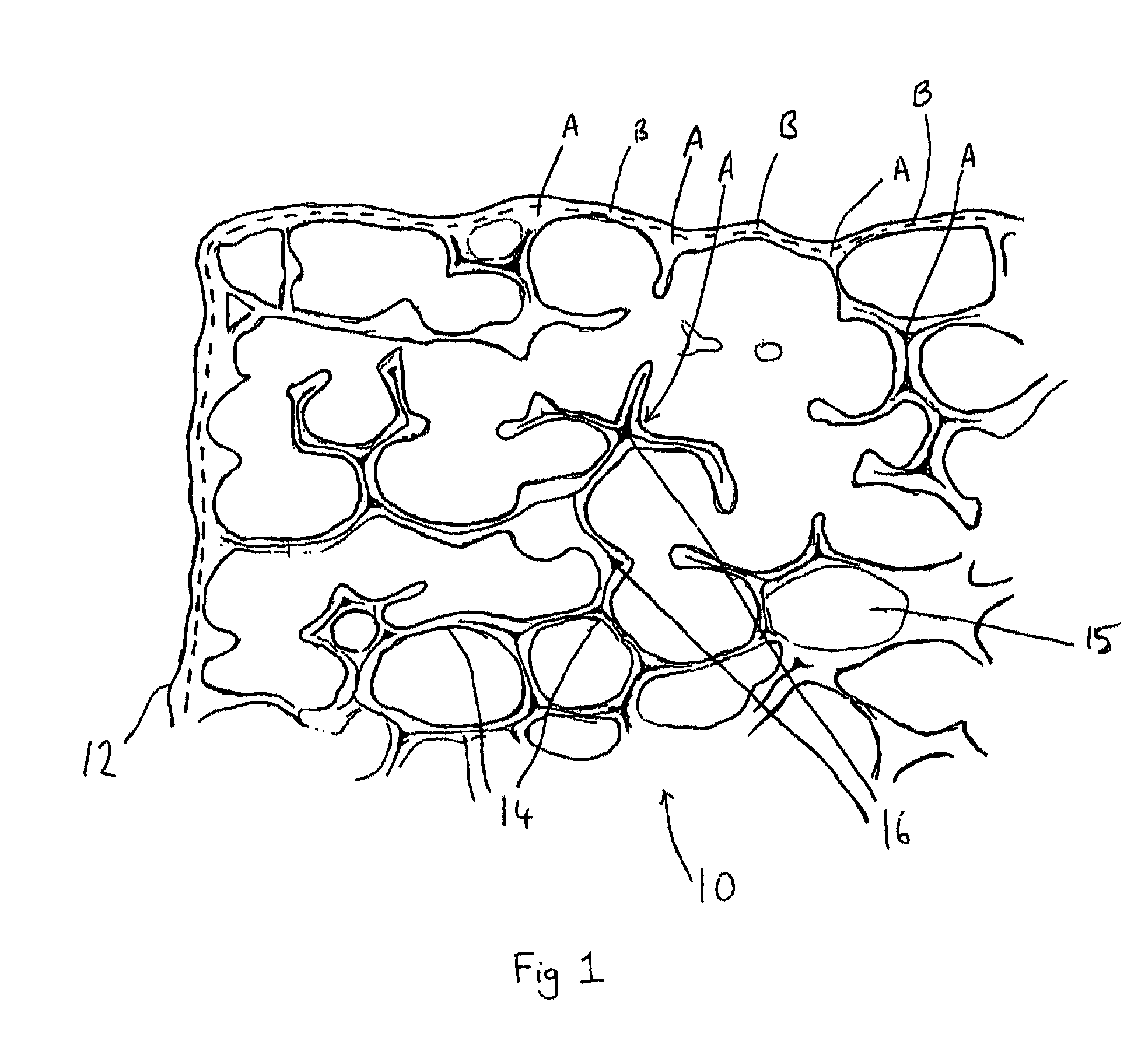 Method for the production of a refractory filter