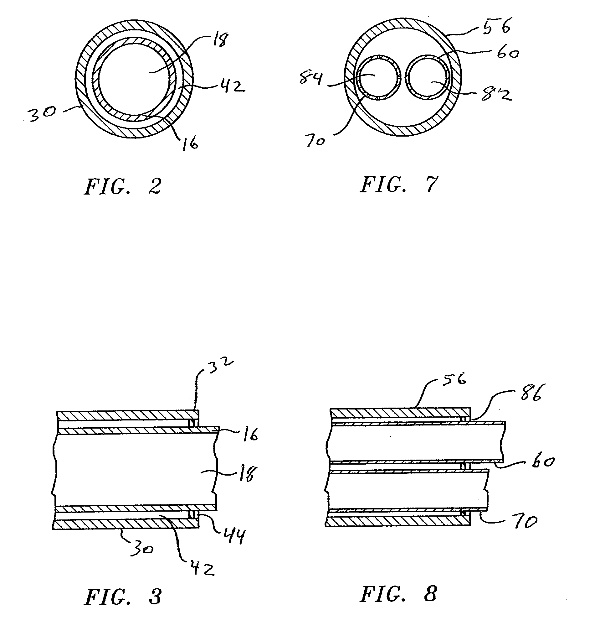 Dual lumen catheter and method for minimally invasive endoluminal surgery