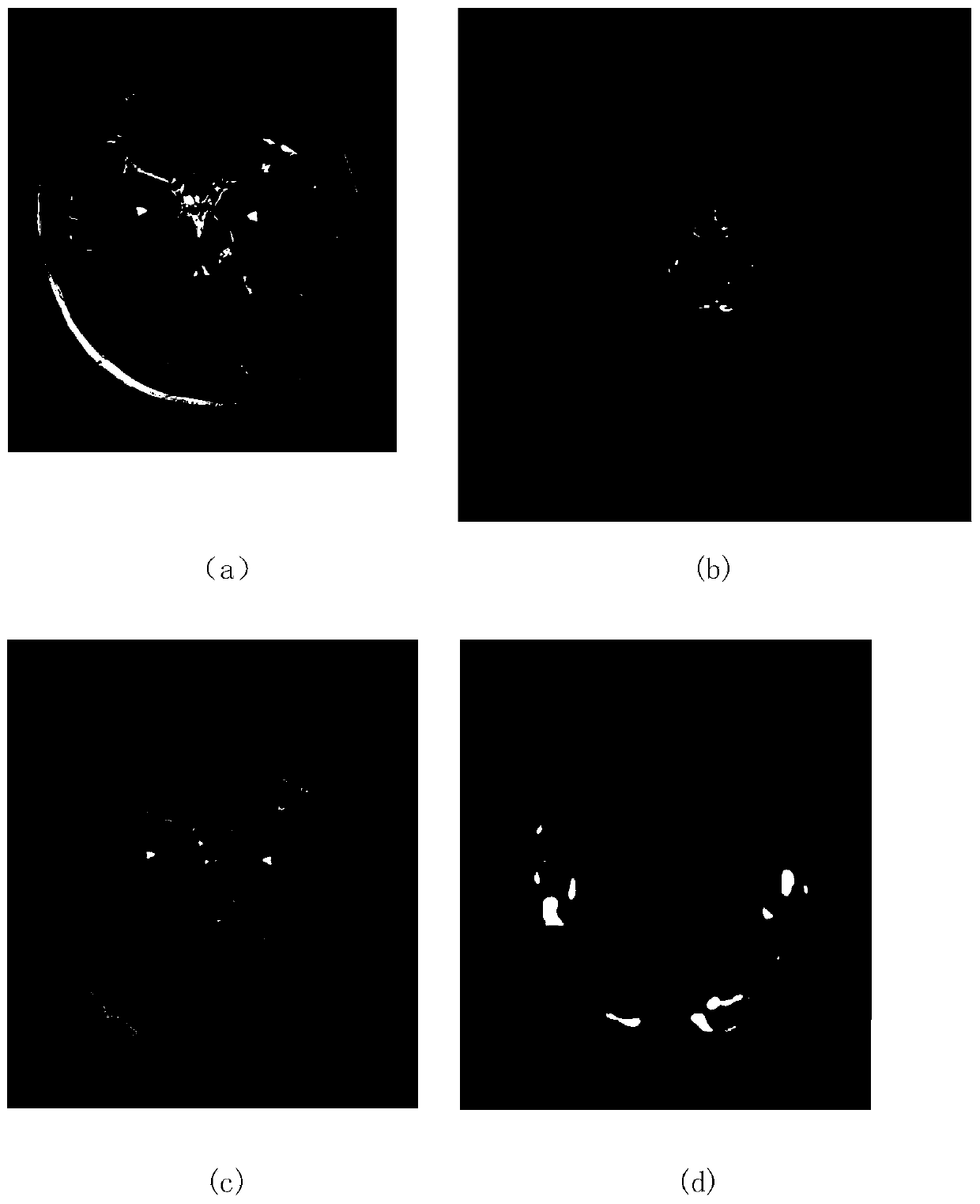 A full convolutional neural network epilepsy focus segmentation method based on multi-mode images