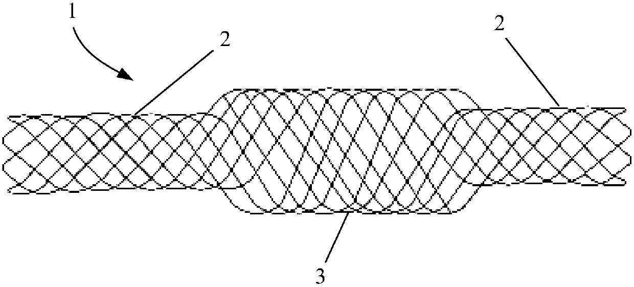 Stent, interventional medical device and interventional medical system