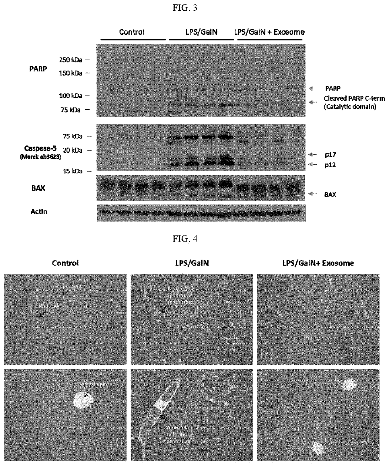 Composition comprising exosome as effective ingredient for prevention or treatment of acute liver failure