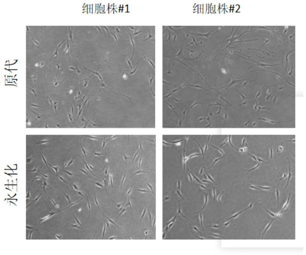 Human orbit preadipocyte cell line, construction method and application