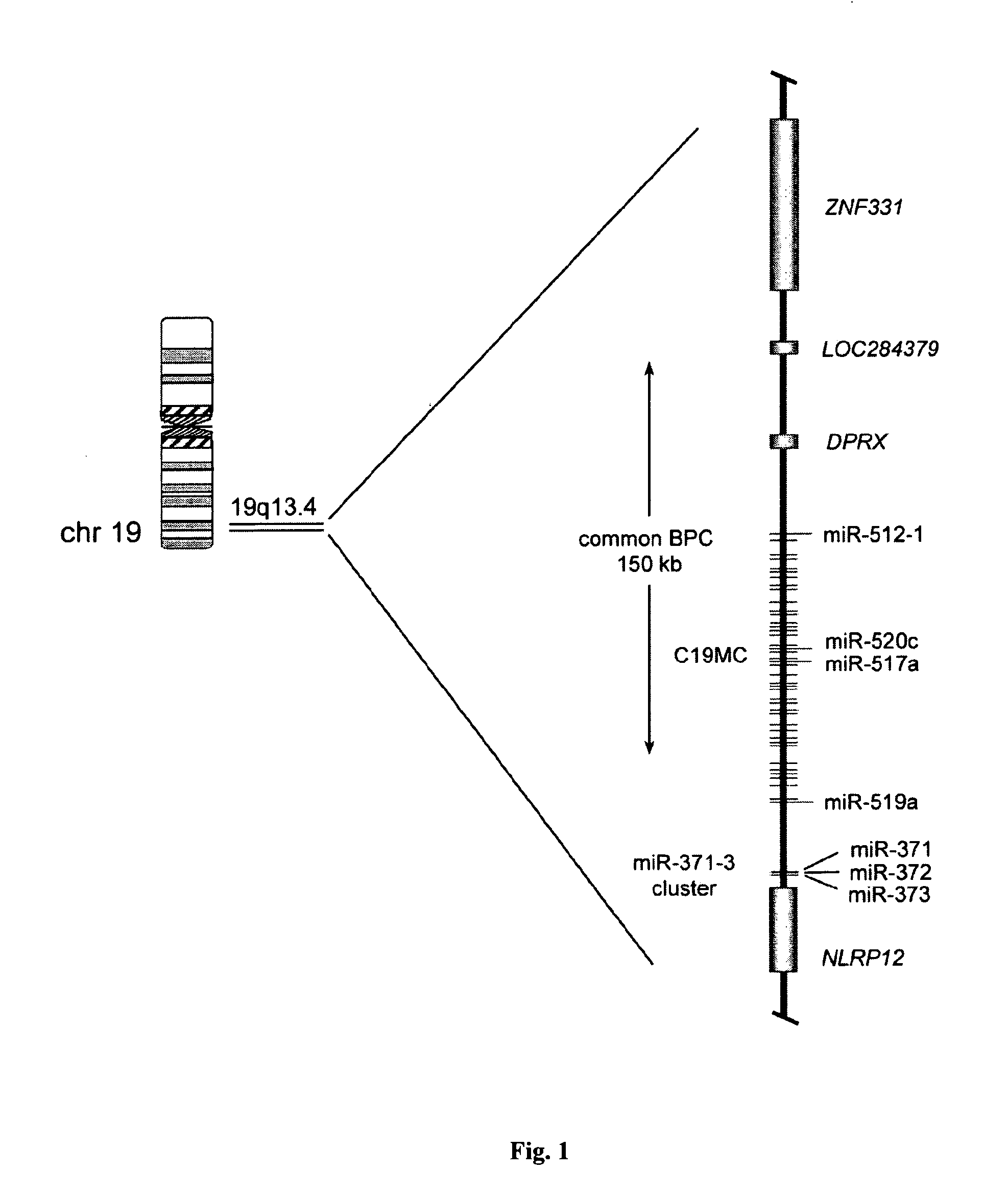 Microrna-based methods and compositions for the diagnosis, prognosis and treatment of tumor involving chromosomal rearrangements