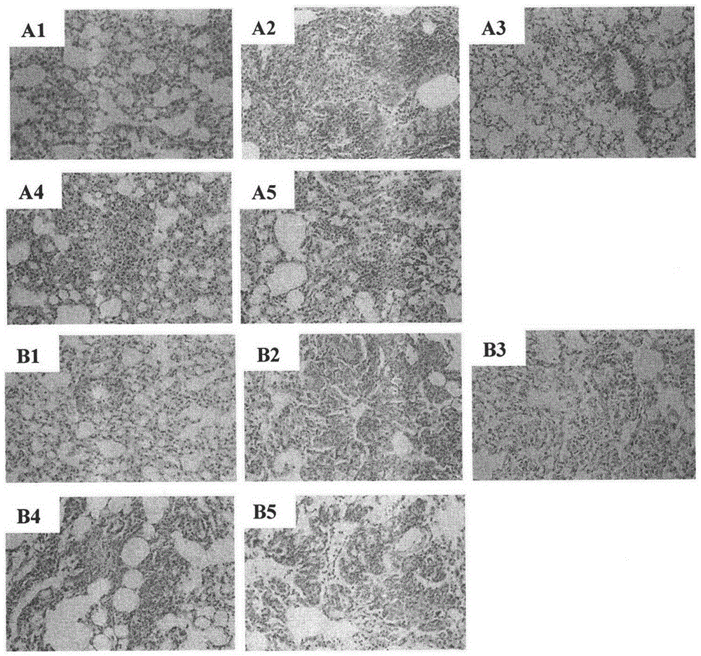 Application of a spirocyclic alkaloid in the preparation of drugs for preventing or treating pulmonary fibrosis