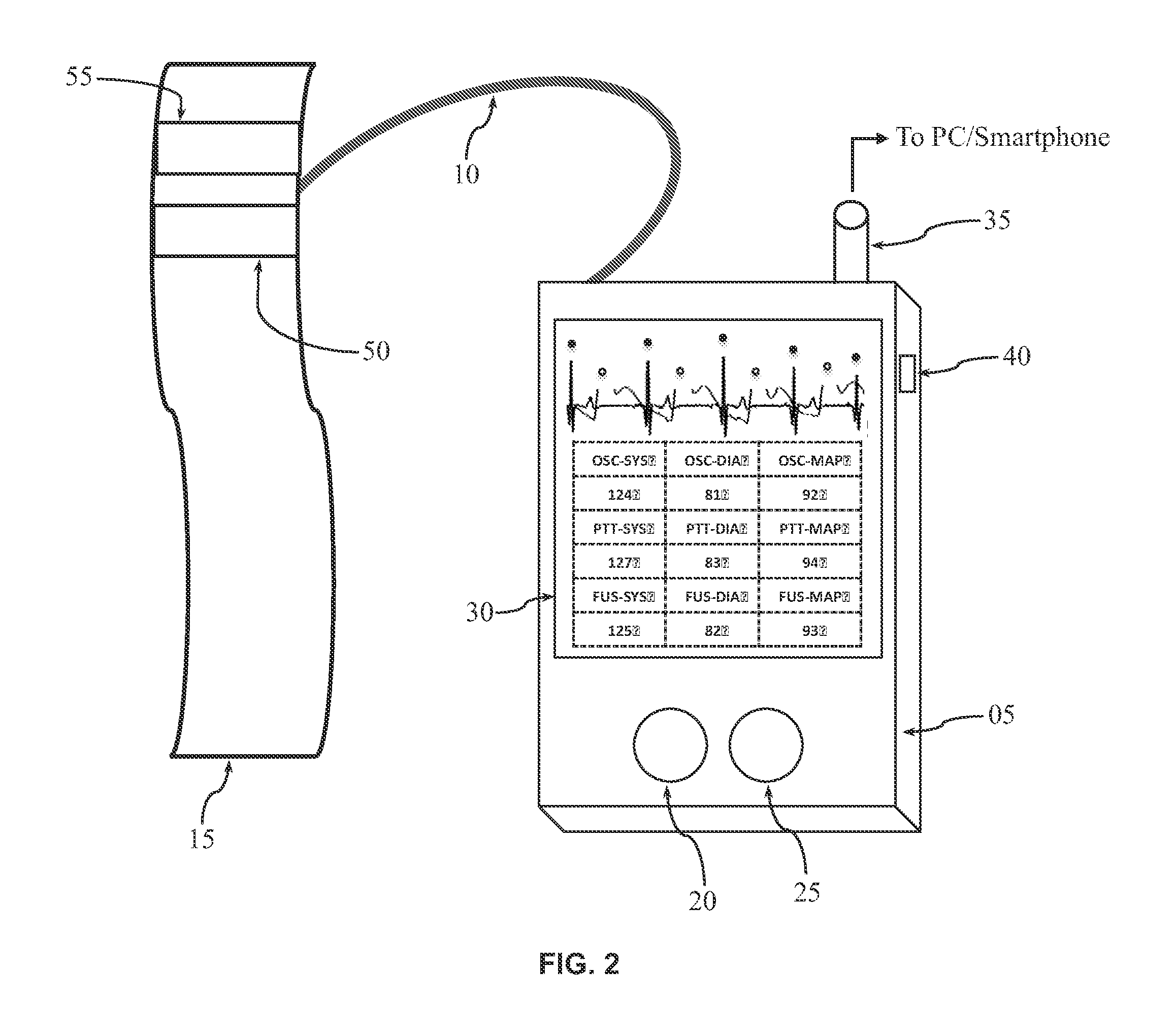 Apparatus and method for electrocardiogram-assisted blood pressure measurement