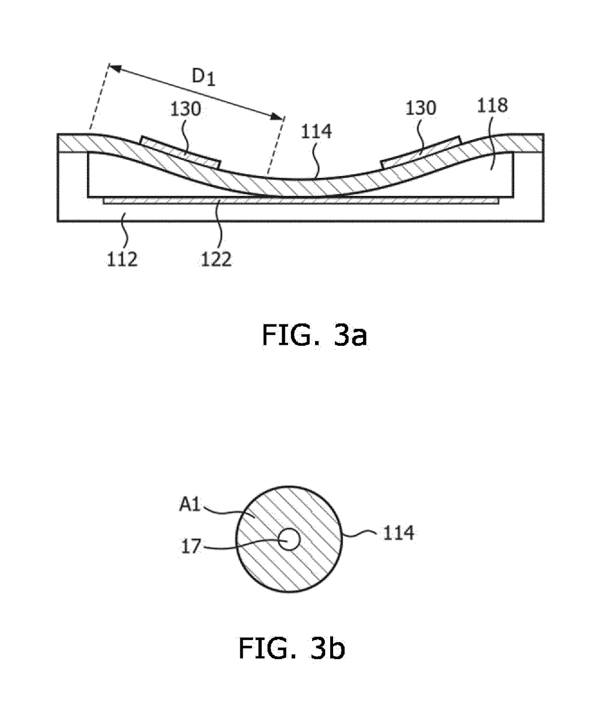 Ultrasound system and method