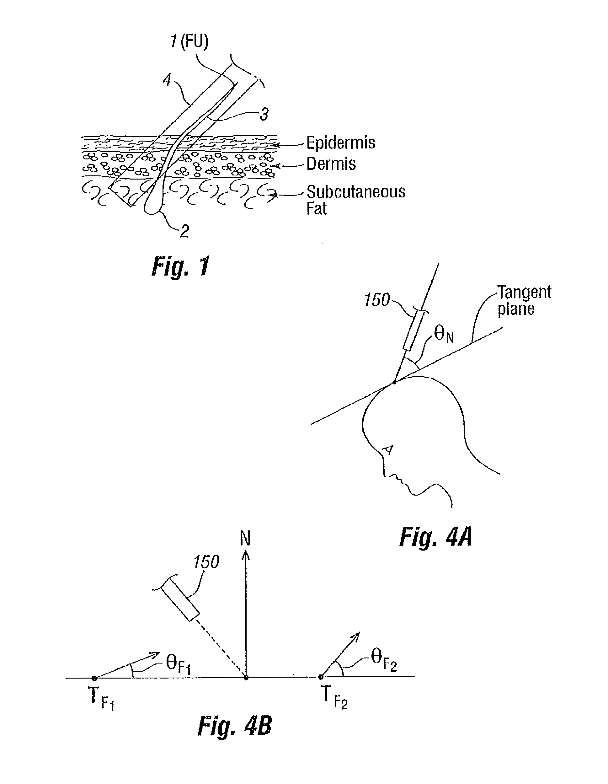 Systems and Methods for Harvesting and Implanting Hair Using Image-Generated Topological Skin Models