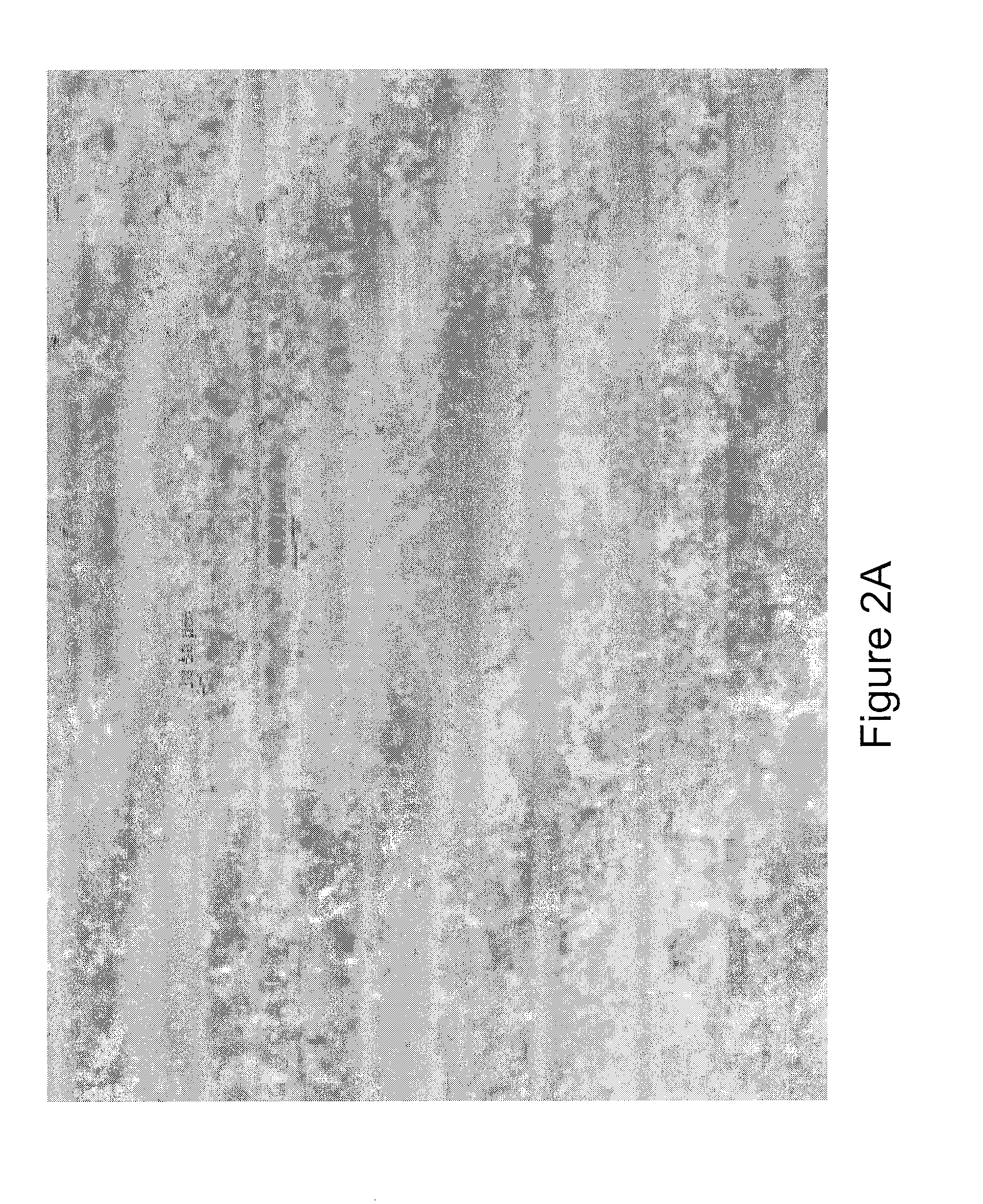 Micropellet compositions comprising pancreatin containing digestive enzyme mixture