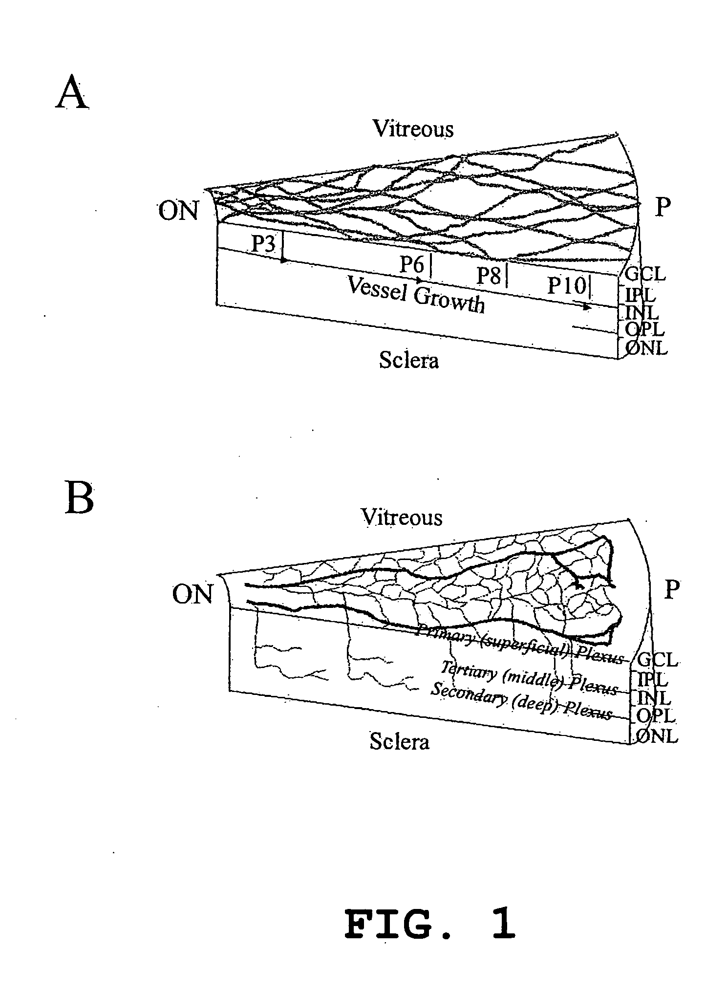 Hematopoietic stem cells and methods of treatment of neovascular eye diseases therewith