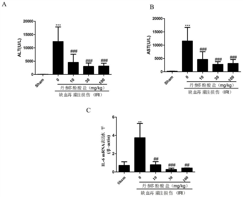 Protective effect and application of magnesium lithospermate B or pharmaceutical composition containing lithospermate B on hepatic ischemia reperfusion