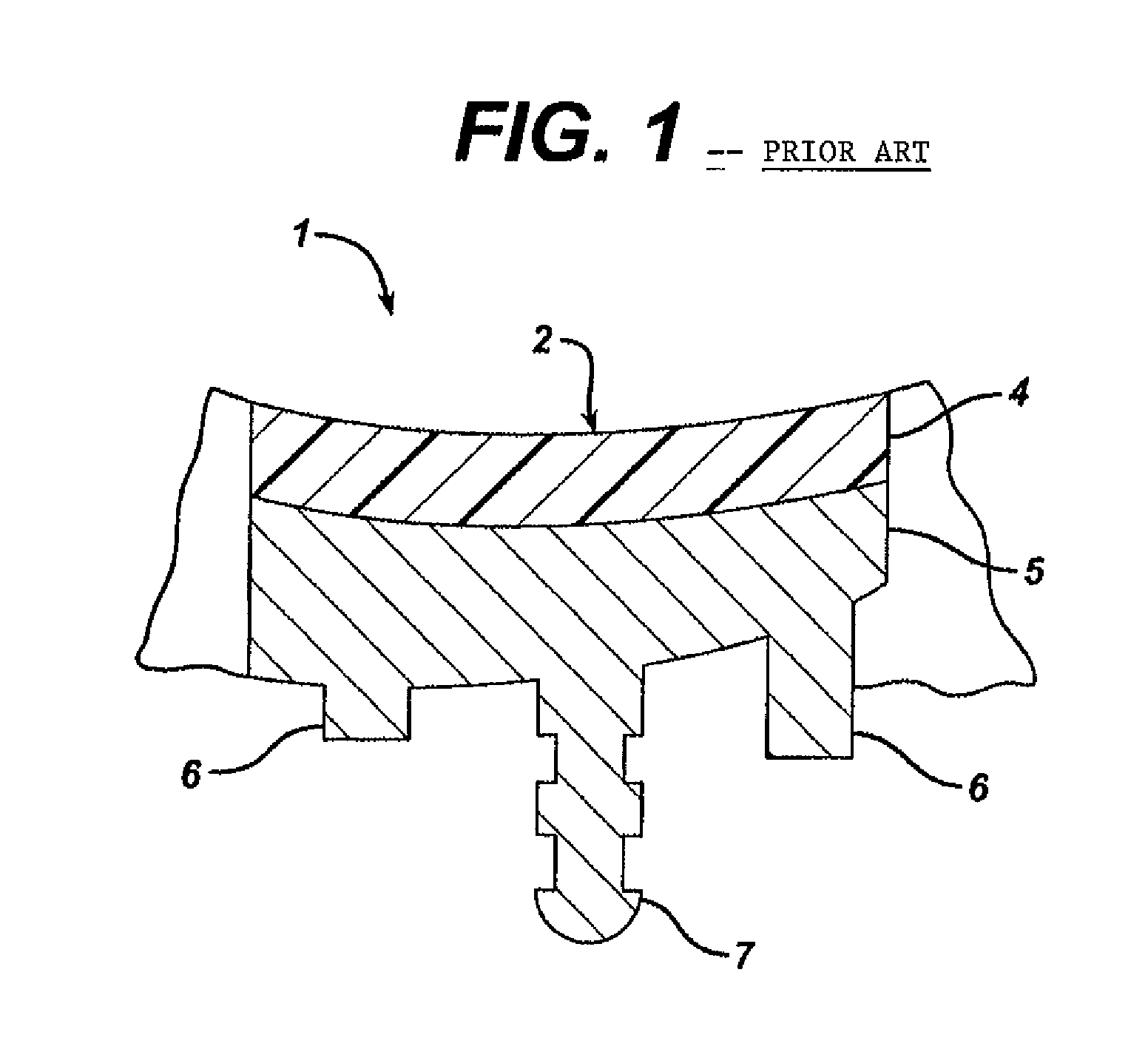 Instrument for preparing an implant support surface and associated method