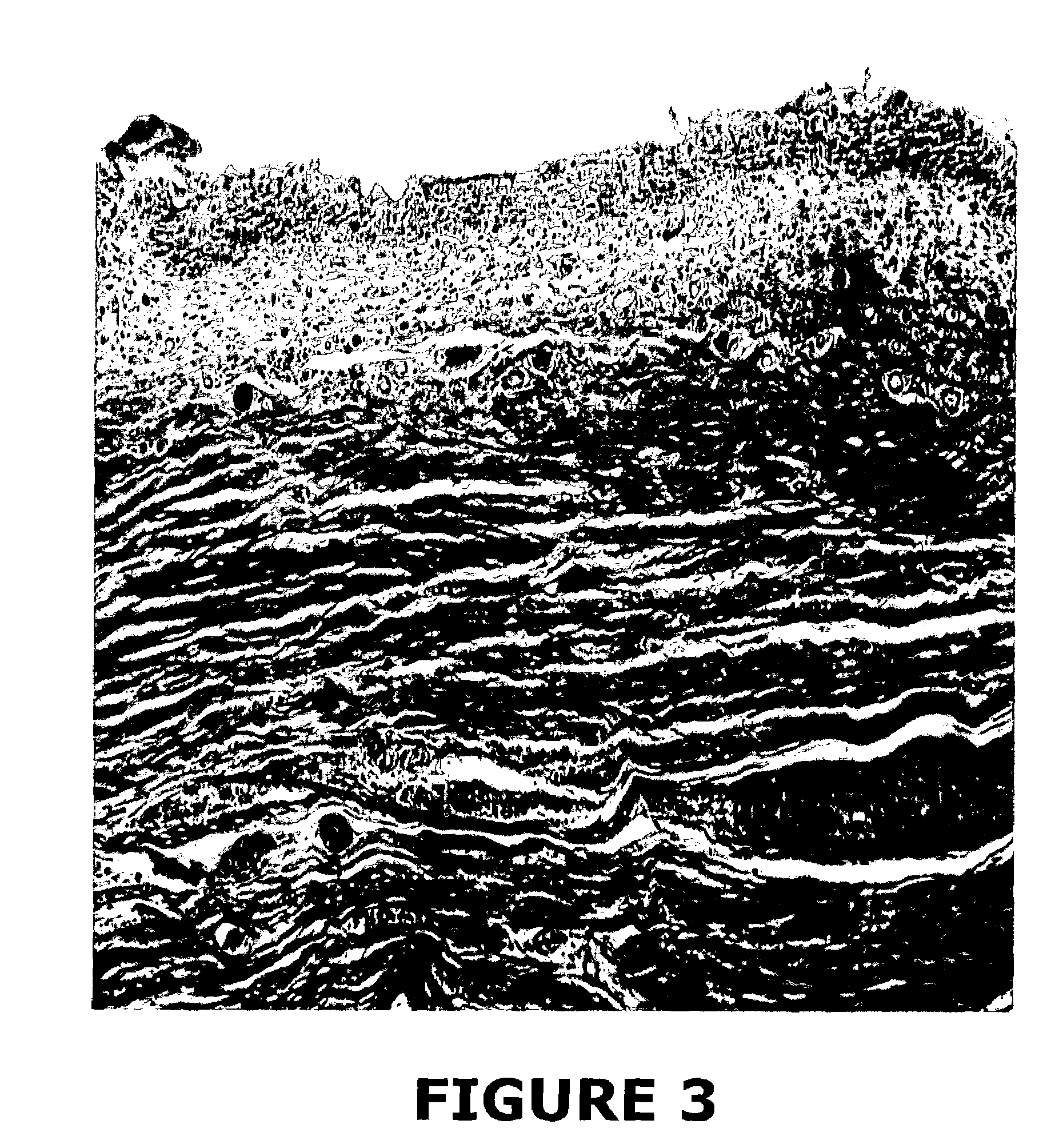 Urinary tract tissue graft compositions and methods for producing same