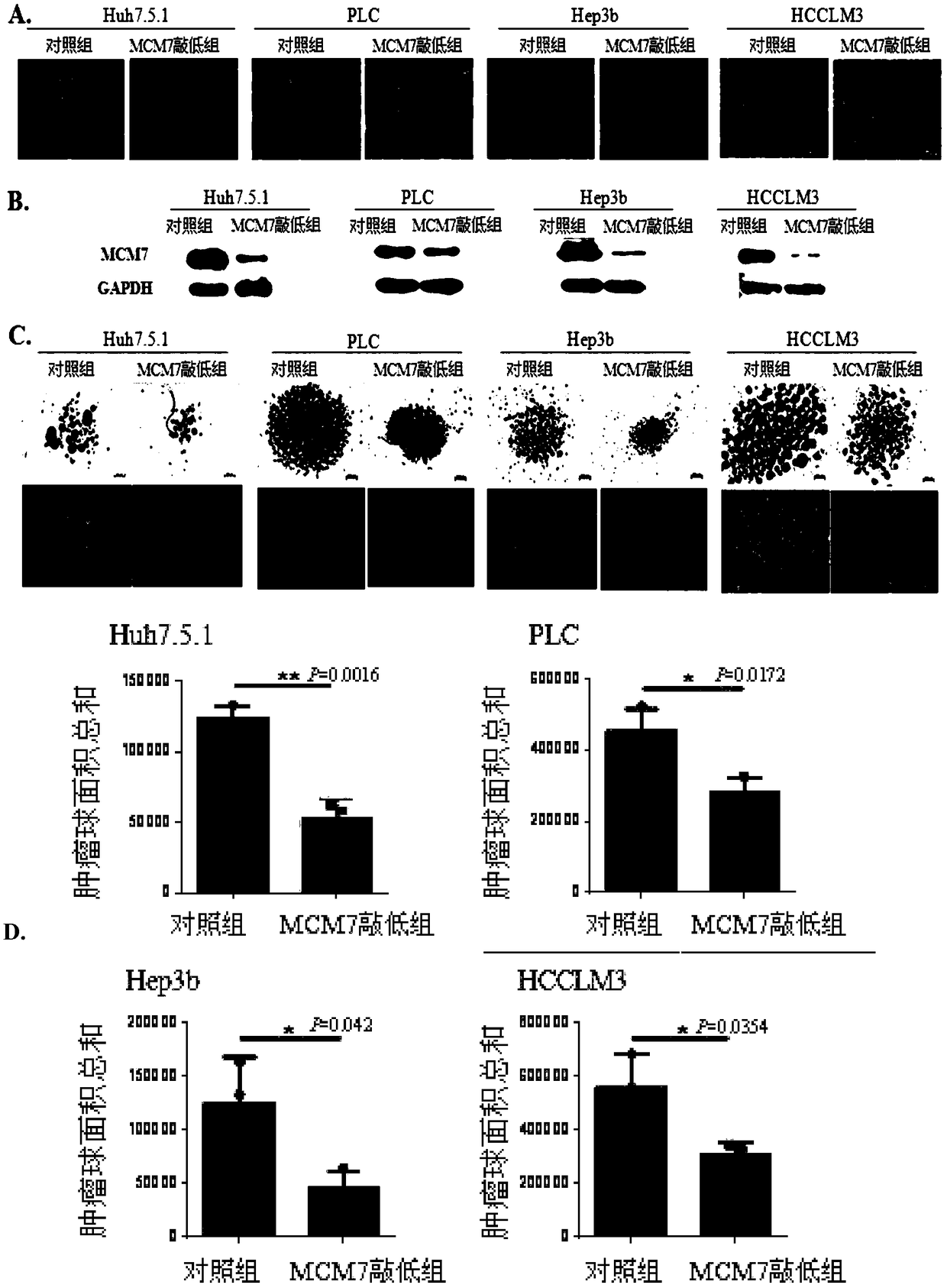 Purpose of reagent in preparing medicine, interference fragments, method for inhibiting self-renewal of liver cancer tumor stem cells, and liver cancer treatment drug