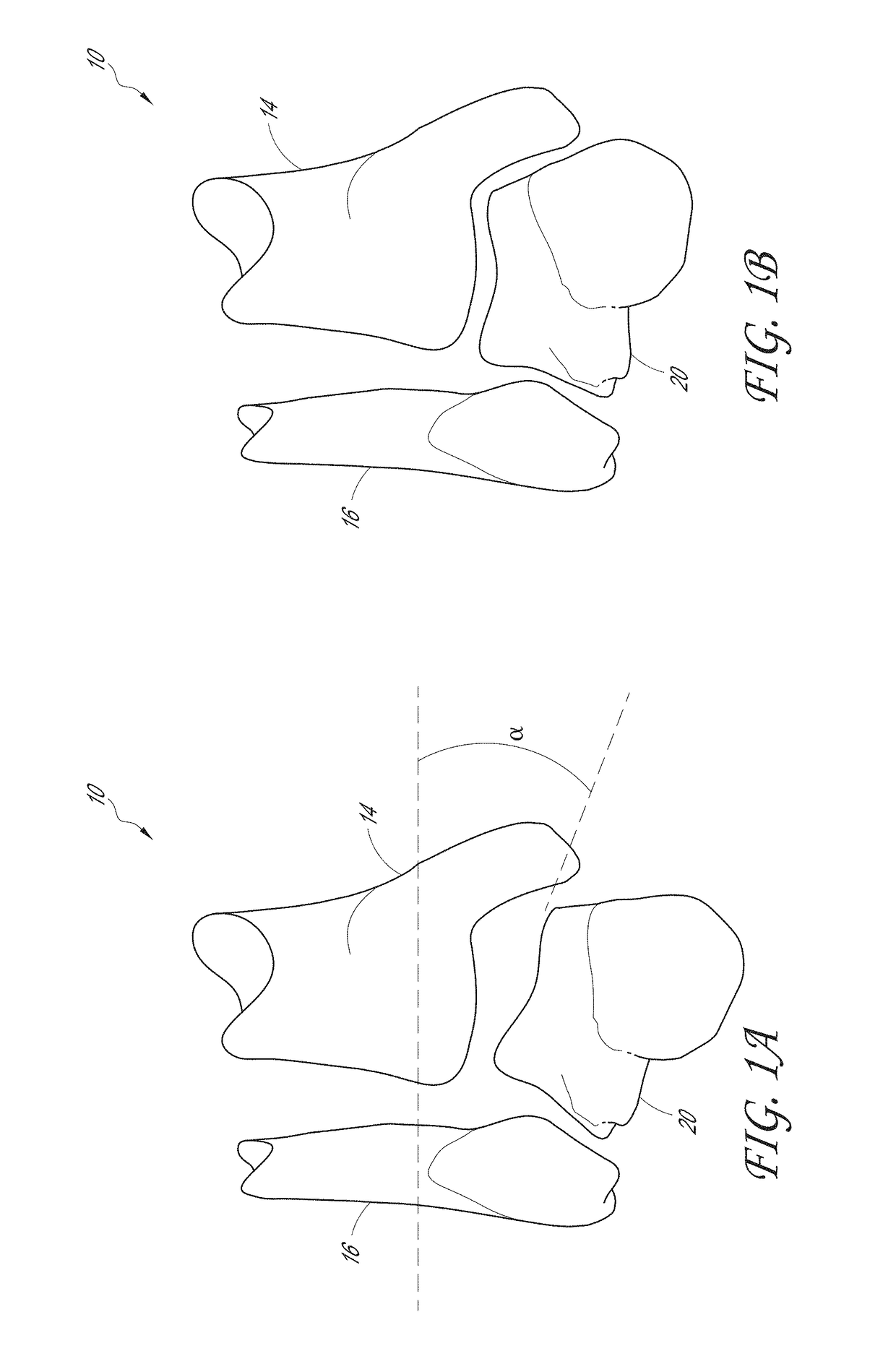 Patient specific instruments and methods for joint prosthesis