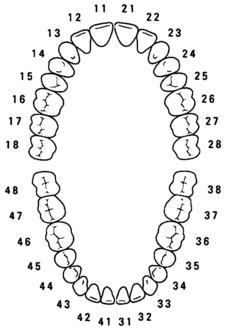 Direct step-by-step method for generating orthodontic states