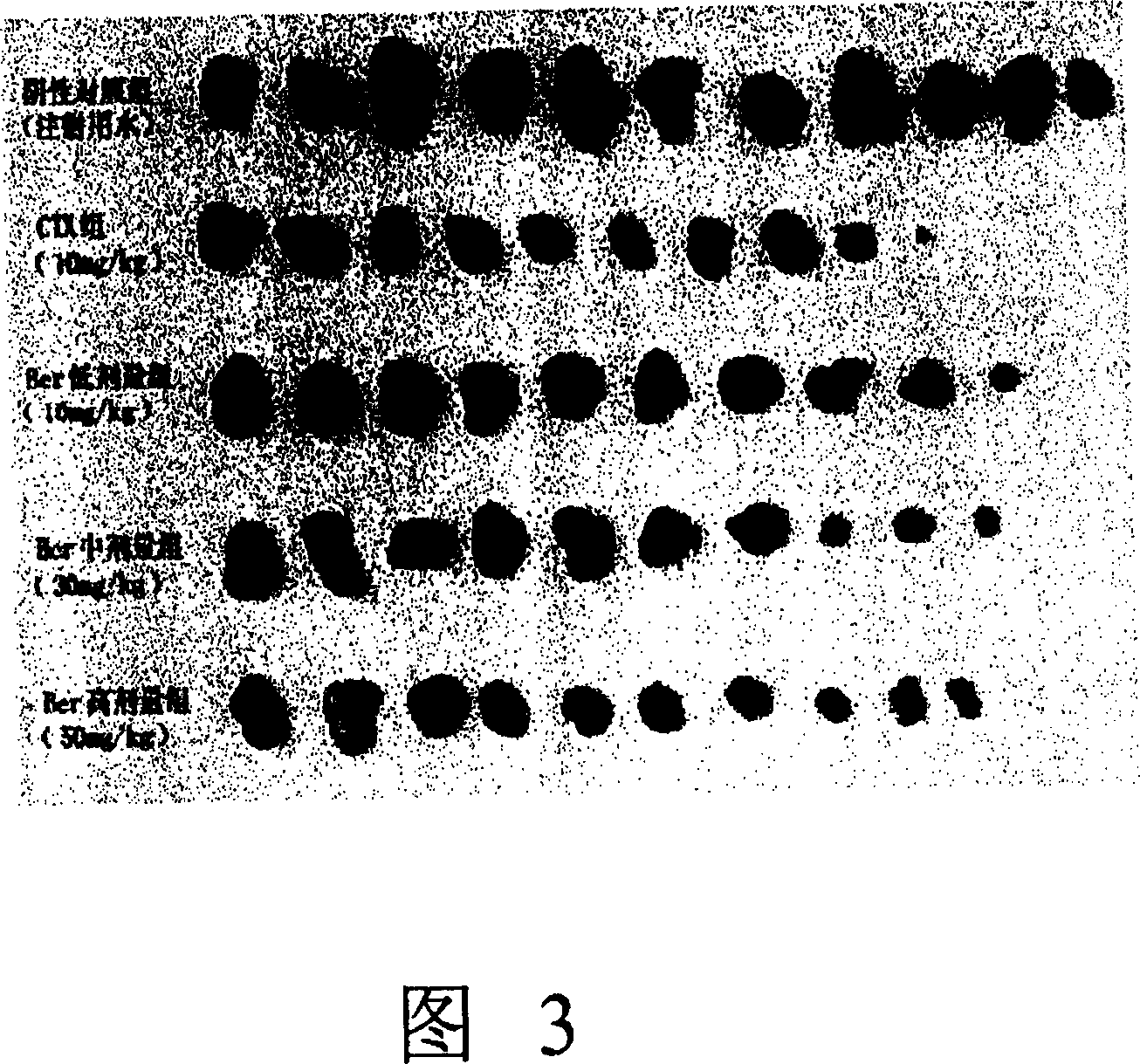 New application of berbamine as intracorporeal antitumor drug