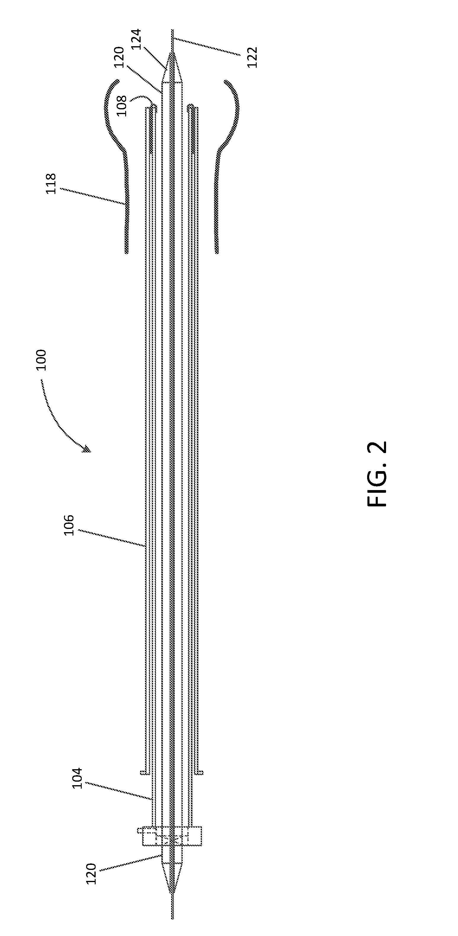 Valve replacement devices and methods