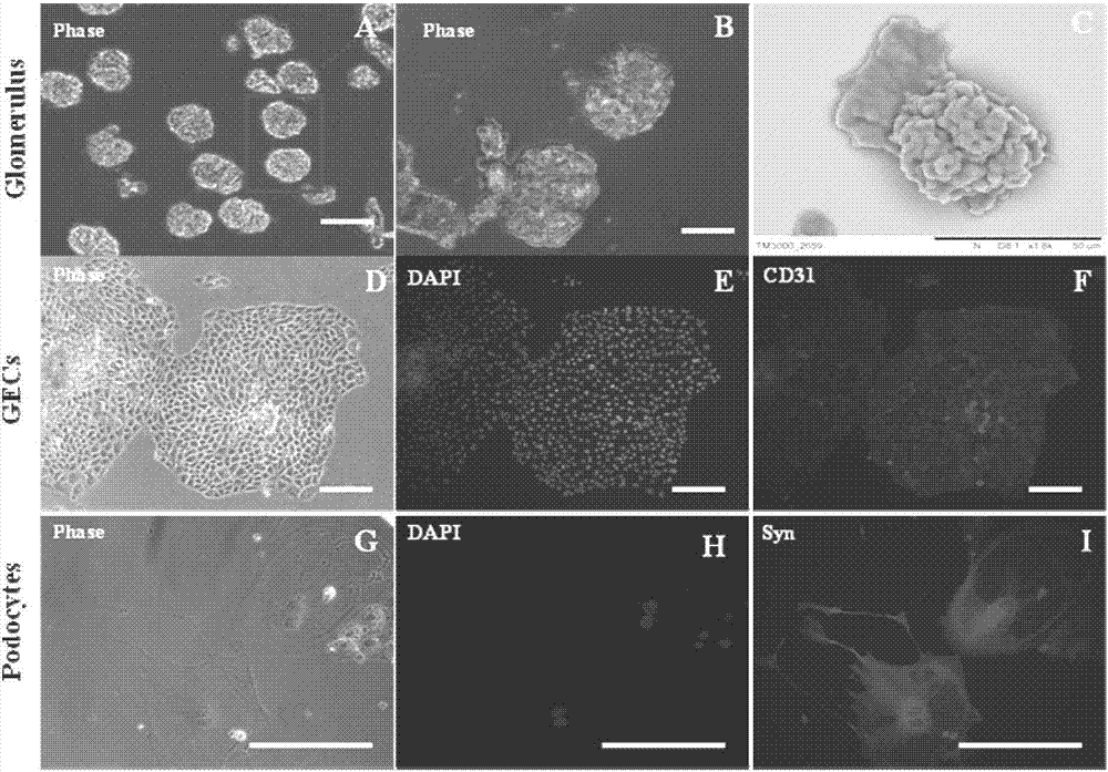 Construction method of in-vitro diabetes mellitus glomerulus model based on micro-fluidic chip