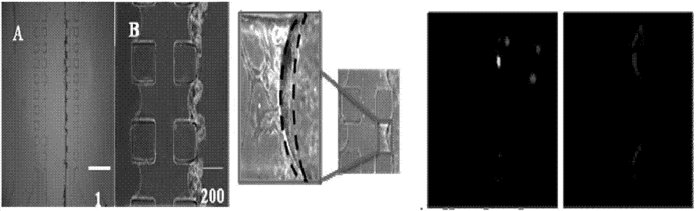 Construction method of in-vitro diabetes mellitus glomerulus model based on micro-fluidic chip