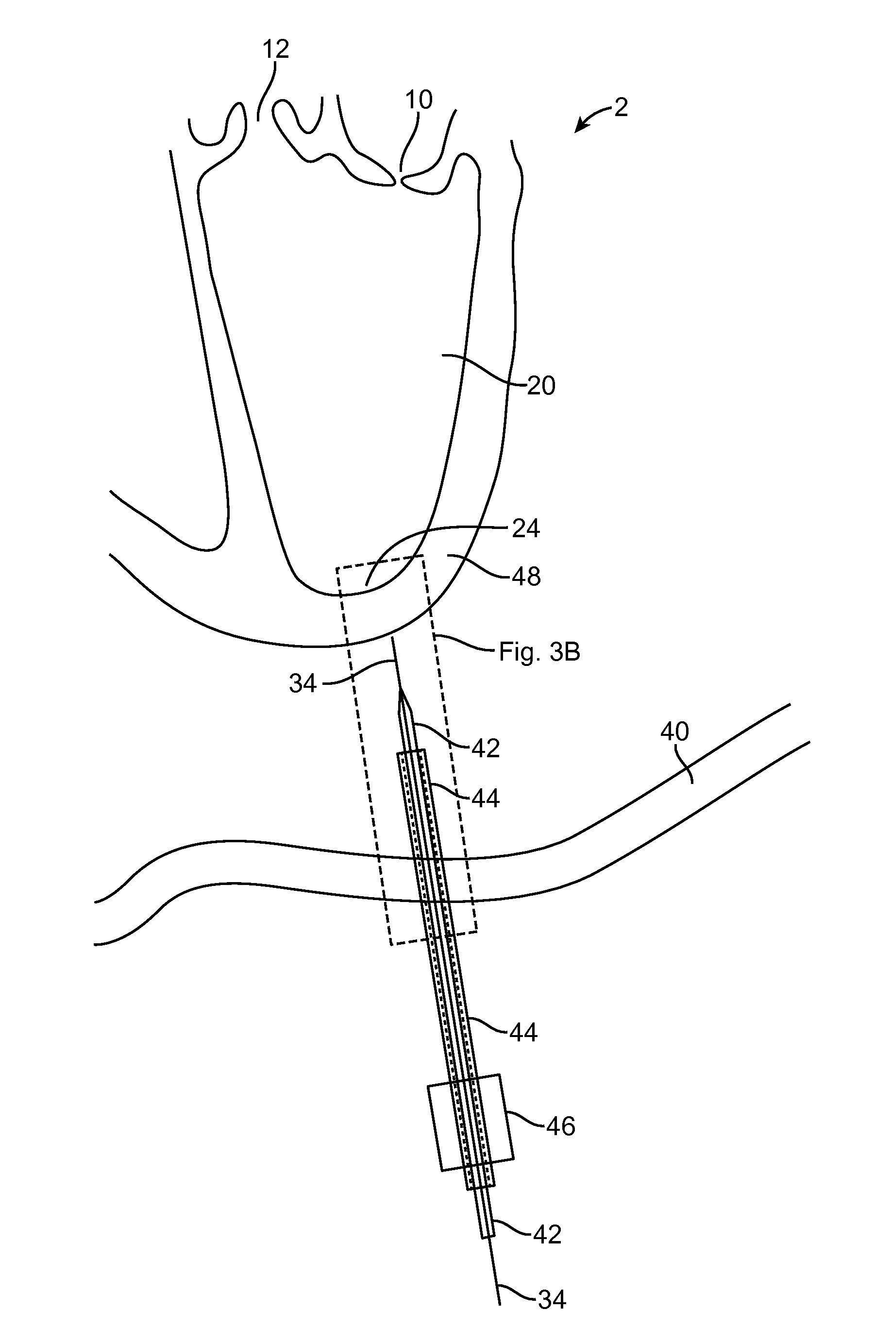 Method for providing surgical access