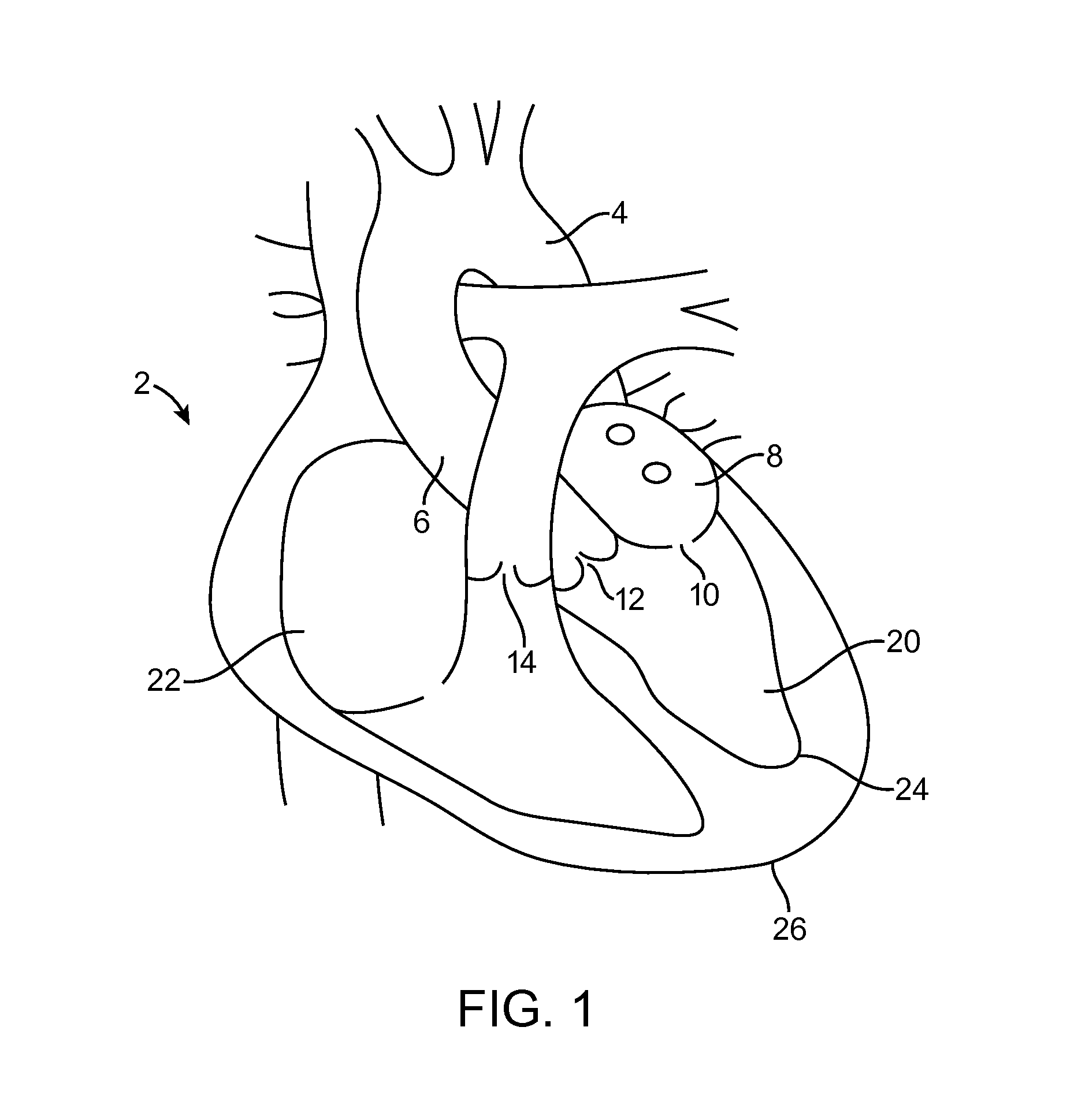 Method for providing surgical access