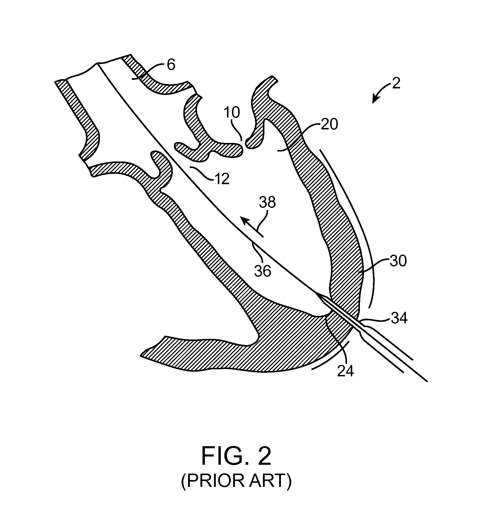 Method for providing surgical access