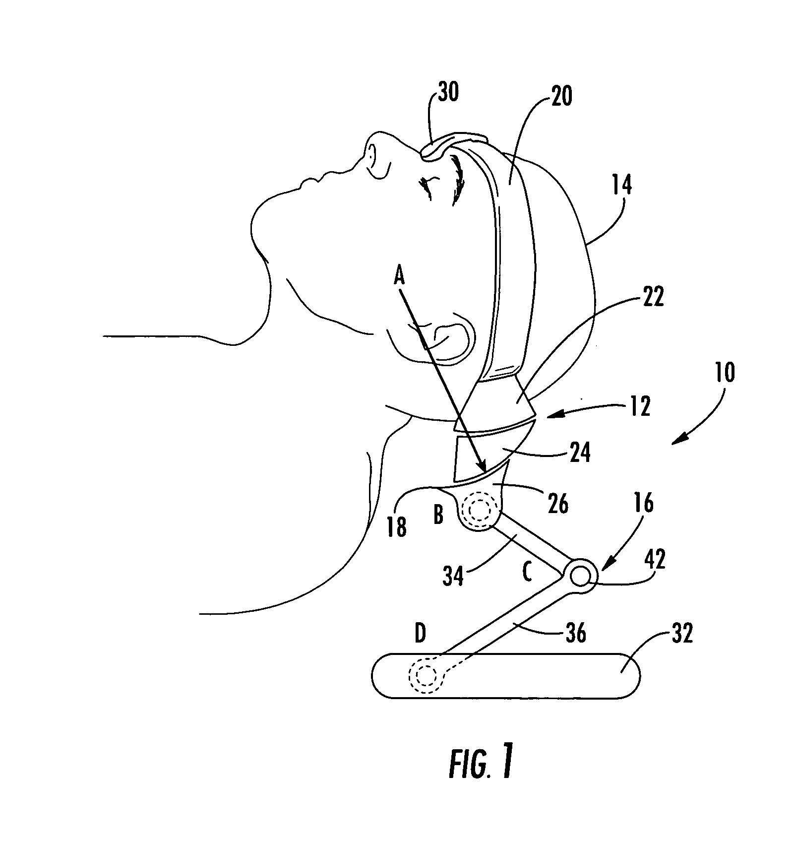 Head positioning device