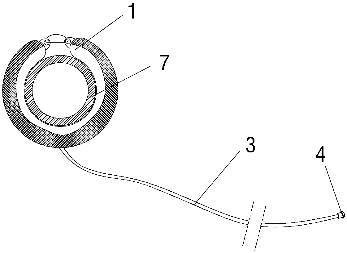 An adjustable blood vessel ring constriction band