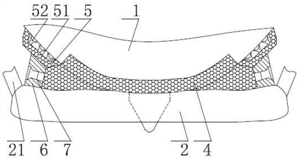 Anti-shedding and anti-infection goggles for medical use