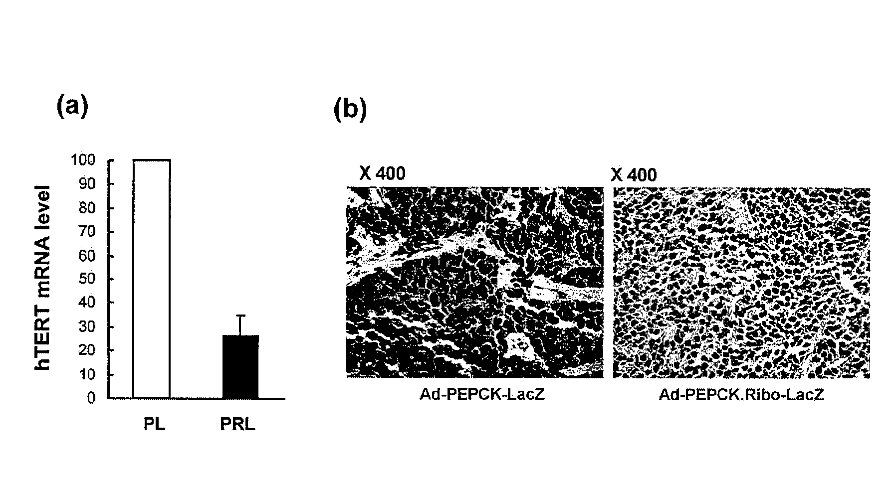 Recombinant adenovirus comprising tissue-specific promoter and tumor-targeting trans-splicing ribozyme and uses thereof