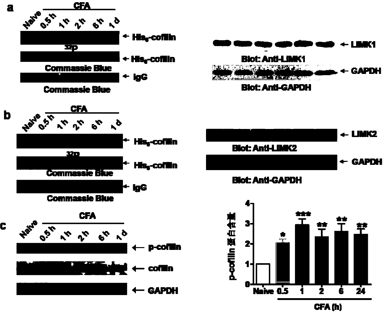 Transmembrane polypeptide with analgesic effect