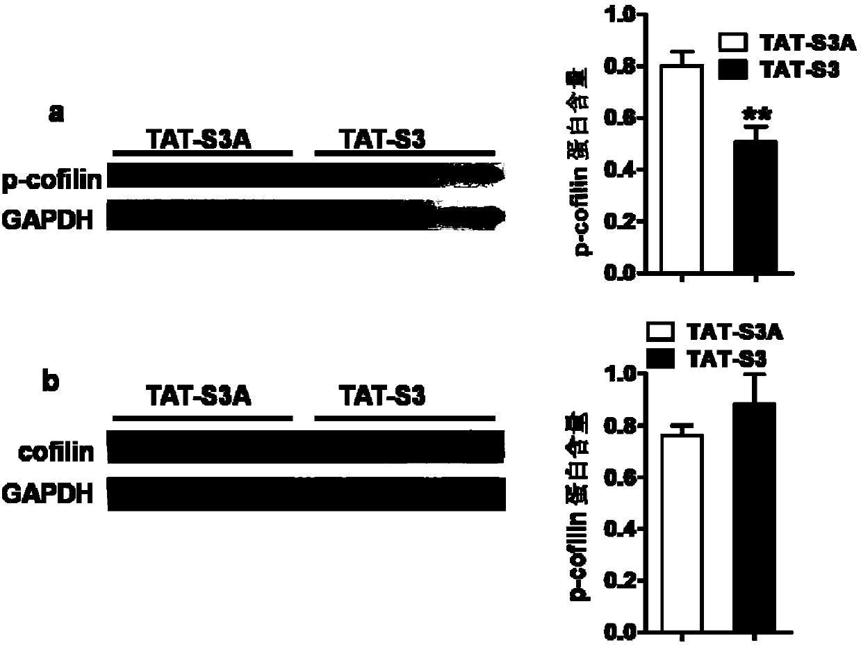 Transmembrane polypeptide with analgesic effect