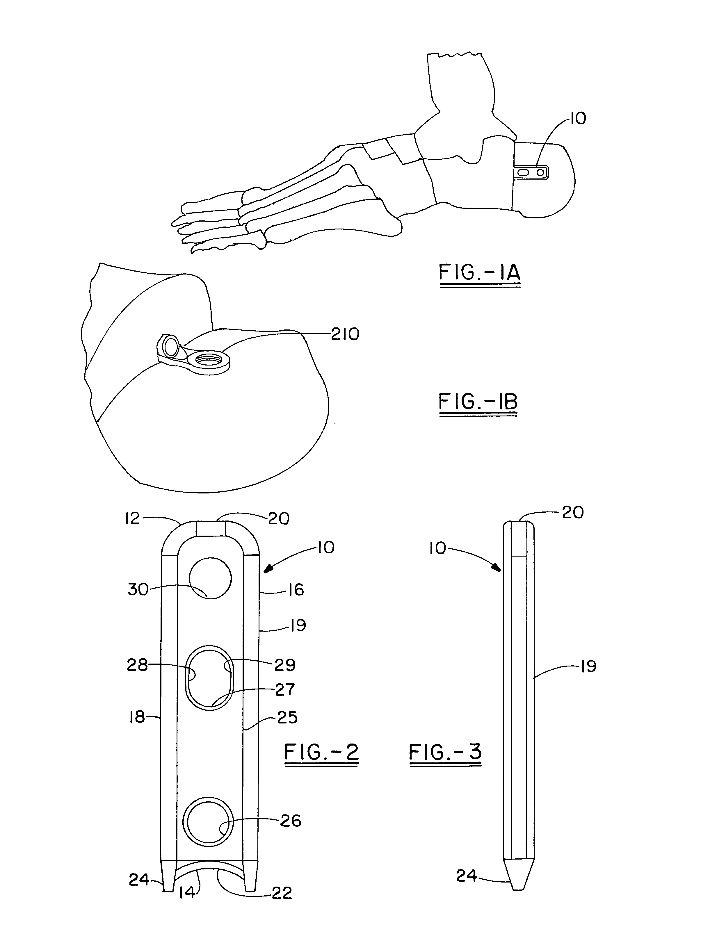 Osteotomy plate, plate driver and method for their use