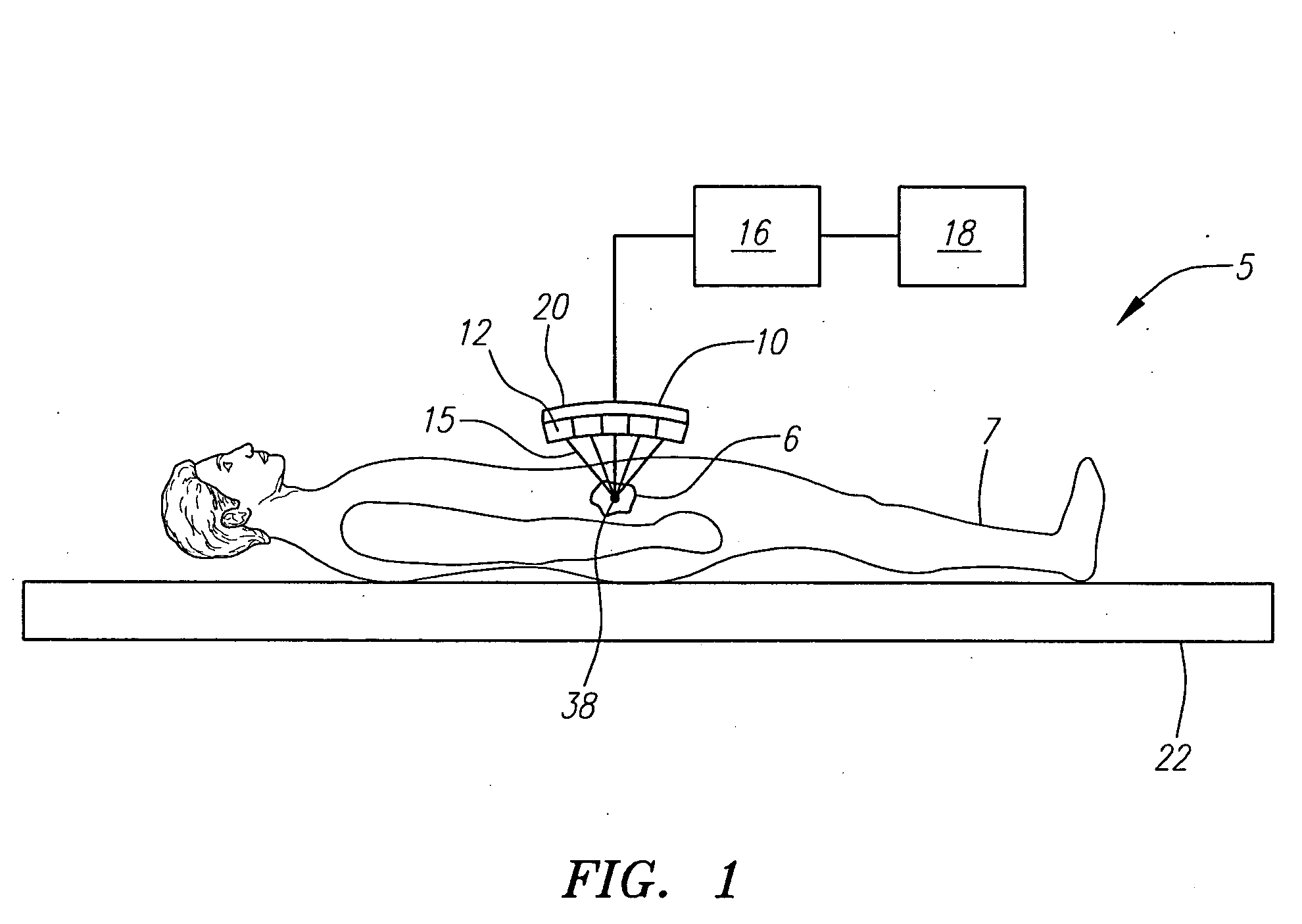 Focused ultrasound system with adaptive anatomical aperture shaping