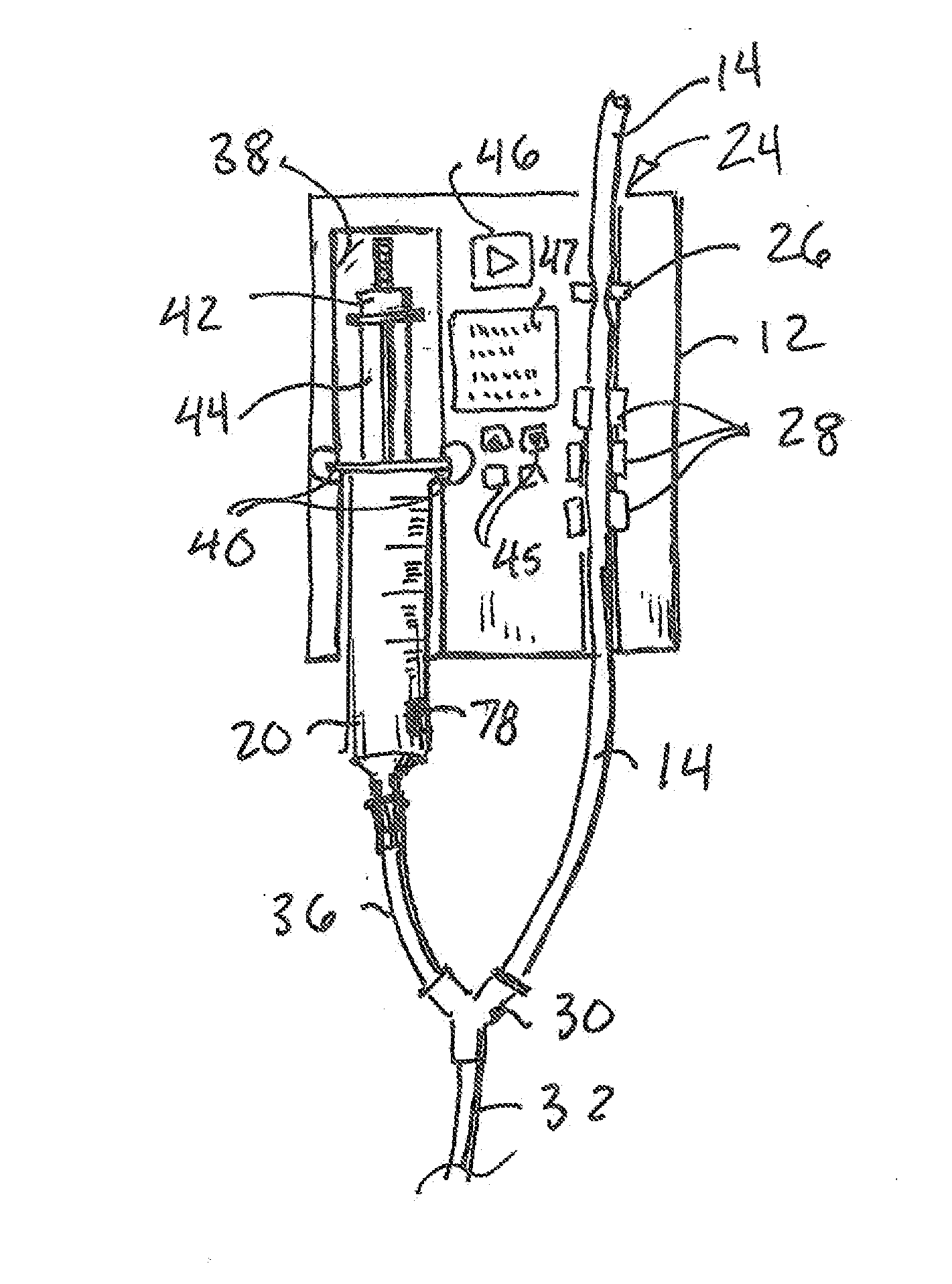 Therapy-specific medical pump