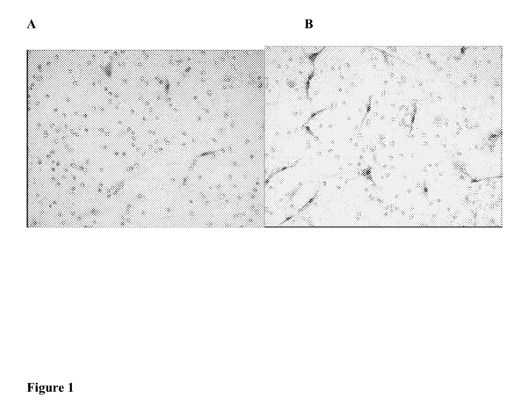 Stem cell targeting of cancer, methods and compositions therefor