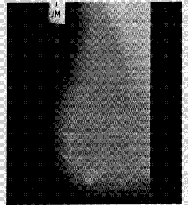 A processing system of unbalanced medical image and processing method thereof
