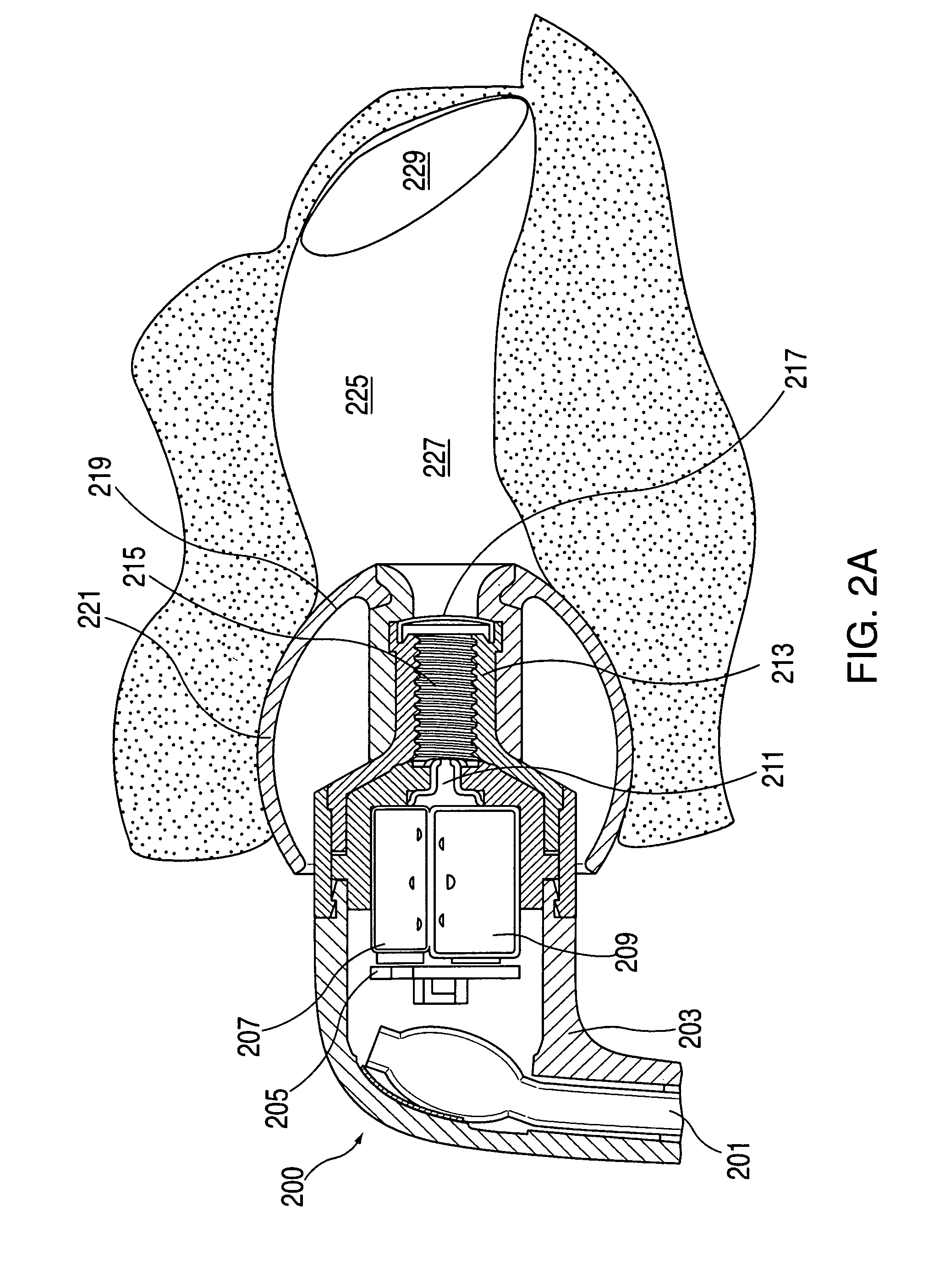 In-the-ear porting structures for earbud
