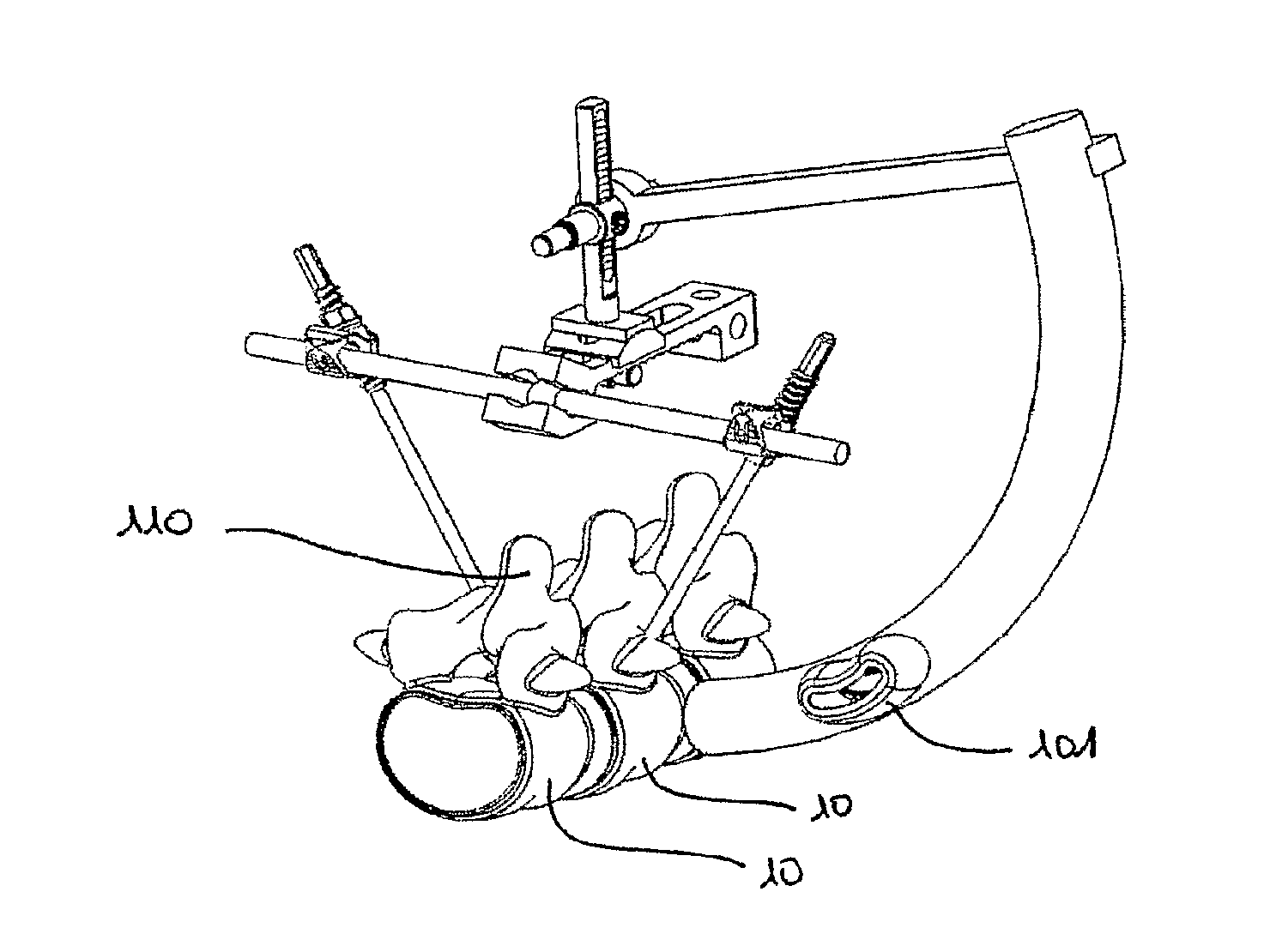 Device for establishing an anatomical reference point of an intervertebral disc