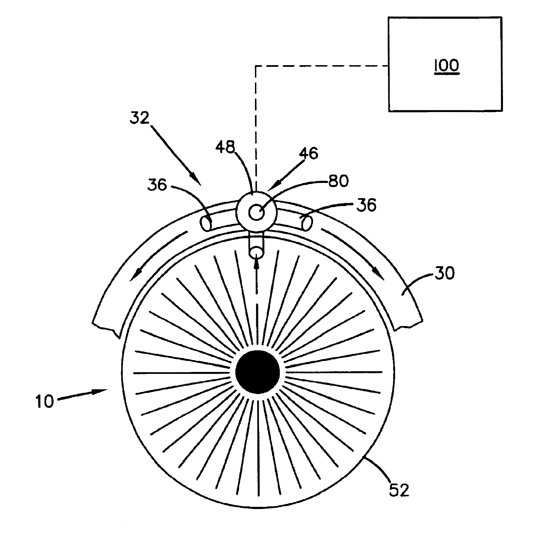 Method and apparatus for treatment of glaucoma