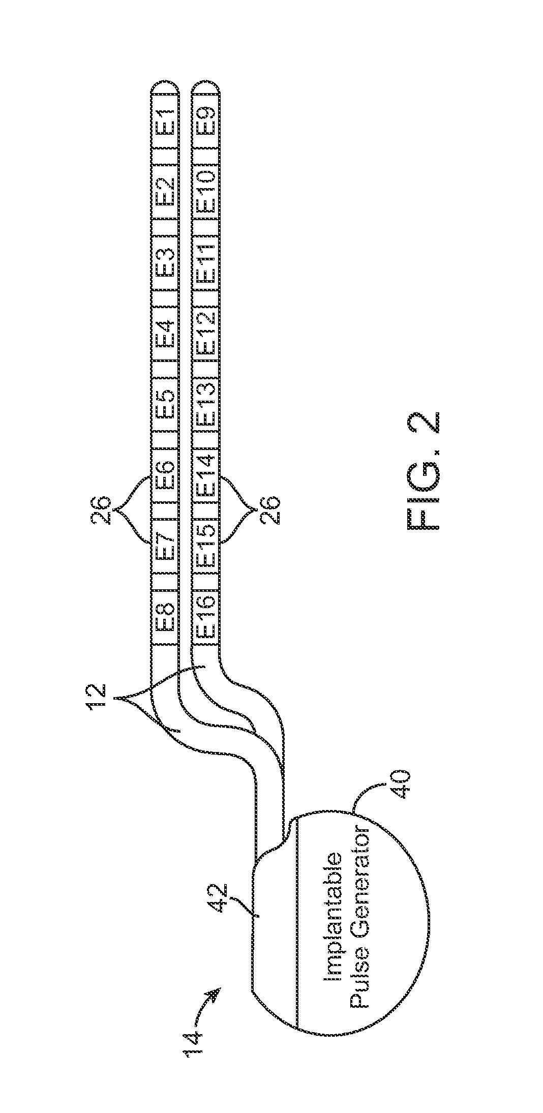System and method for adjusting automatic pulse parameters to selectively activate nerve fibers