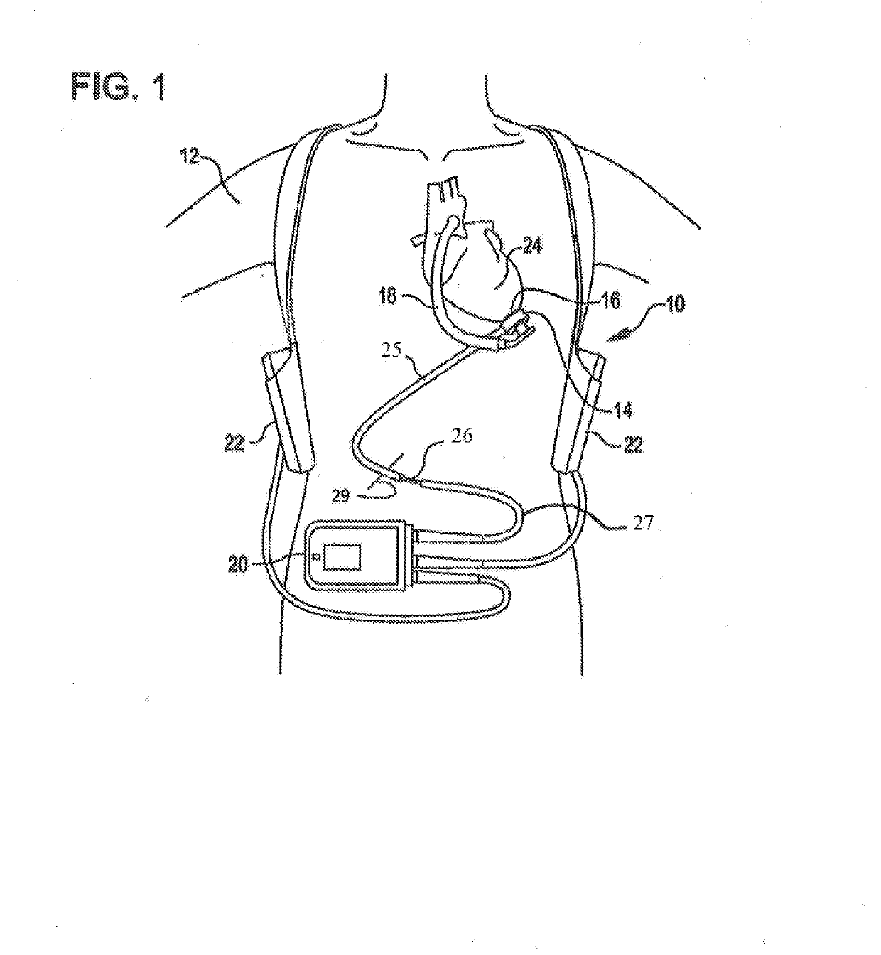 Fluid treatment system for a driveline cable and methods of assembly and use